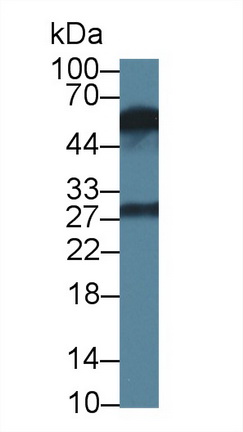 Monoclonal Antibody to Killer Cell Immunoglobulin Like Receptor 2DS4 (KIR2DS4)