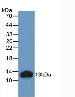 Monoclonal Antibody to Fatty Acid Binding Protein 1 (FABP1)