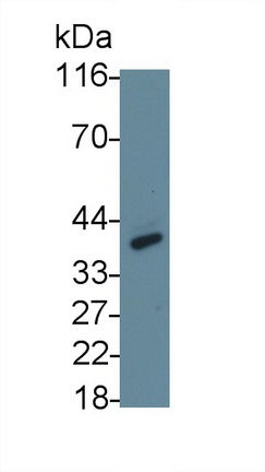 Monoclonal Antibody to Cluster Of Differentiation 23 (CD23)