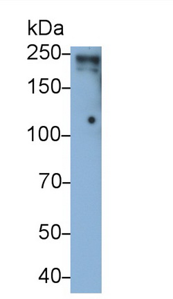 Monoclonal Antibody to Lymphocyte Antigen 75 (LY75)