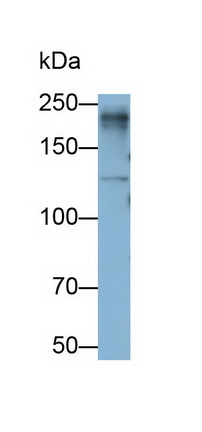 Monoclonal Antibody to Lymphocyte Antigen 75 (LY75)