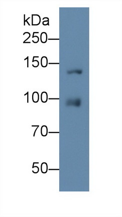 Monoclonal Antibody to Insulin Like Growth Factor 1 Receptor (IGF1R)