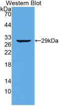 Monoclonal Antibody to Titin (TTN)