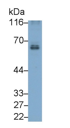 Monoclonal Antibody to Cluster Of Differentiation 226 (C<b>D226</b>)