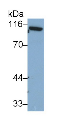 Monoclonal Antibody to Complement Component 1, S Subcomponent (C1s)