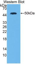 Monoclonal Antibody to Interleukin 28A (IL28A)