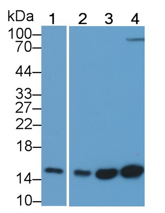 Monoclonal Antibody to Fatty Acid Binding Protein 4 (FABP4)