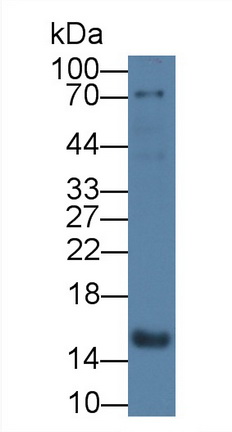 Monoclonal Antibody to Fatty Acid Binding Protein 4 (FABP4)