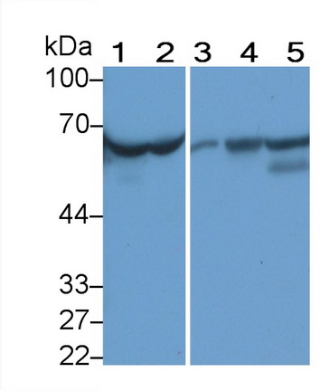 Monoclonal Antibody to Alpha-1-Antitrypsin (a1AT)