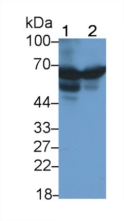 Monoclonal Antibody to Alpha-1-Antitrypsin (a1AT)