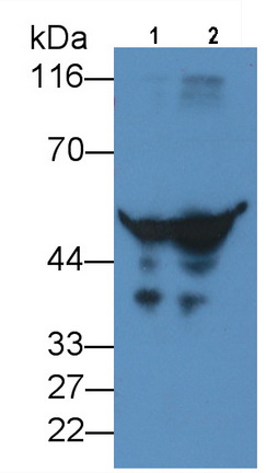 Monoclonal Antibody to Alpha-1-Antitrypsin (a1AT)