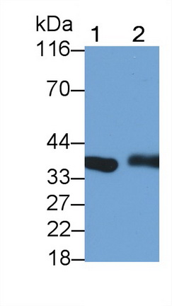 Monoclonal Antibody to Lactate Dehydrogenase B (LDHB)