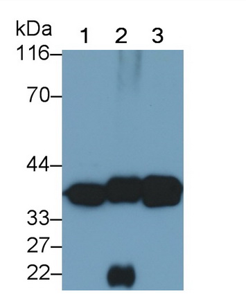 Monoclonal Antibody to Lactate Dehydrogenase B (LDHB)