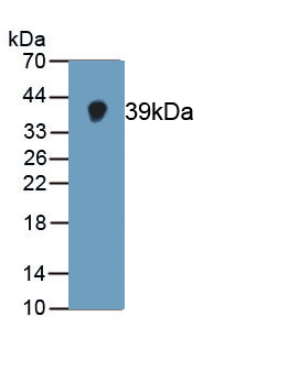 Monoclonal Antibody to TATA Binding Protein (TBP)