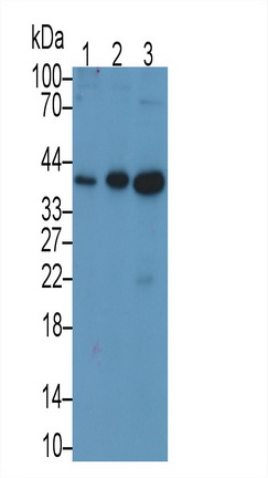 Monoclonal Antibody to TATA Binding Protein (TBP)