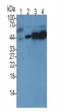 Monoclonal Antibody to TATA Binding Protein (TBP)