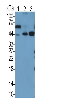 Monoclonal Antibody to TATA Binding Protein (TBP)