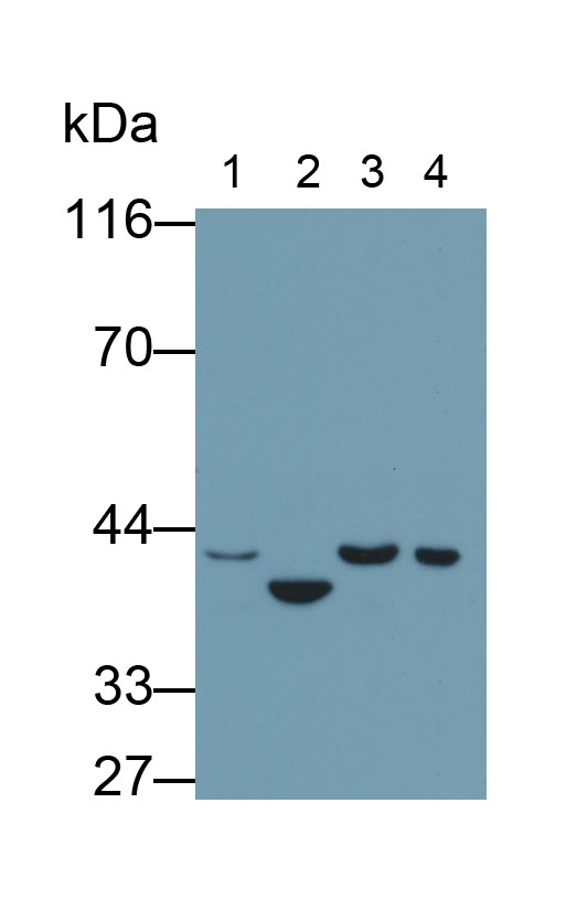 Monoclonal Antibody to TATA Binding Protein (TBP)