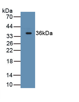 Monoclonal Antibody to Cluster Of Differentiation (CD163)