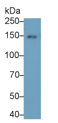 Monoclonal Antibody to Cluster Of Differentiation (CD163)