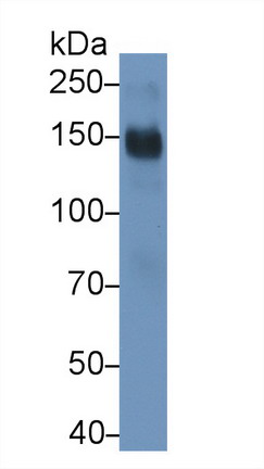 Monoclonal Antibody to Cluster Of Differentiation (CD163)