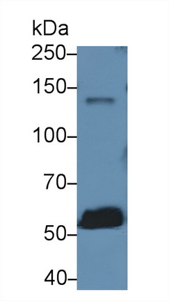 Monoclonal Antibody to Cluster Of Differentiation (CD163)