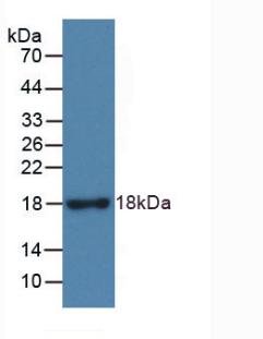 Monoclonal Antibody to Ribonuclease A3 (RNASE3)