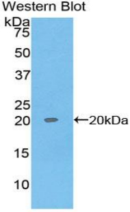 Monoclonal Antibody to Regenerating Islet Derived Protein 1 Alpha (REG1a)