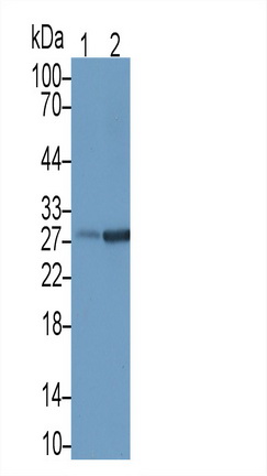 Monoclonal Antibody to Killer Cell Lectin Like Receptor Subfamily K, Member 1 (KLRK1)