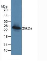 Monoclonal Antibody to Lectin Galactoside Binding, Soluble 3 Binding Protein (LGALS3BP)