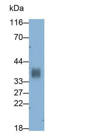 Monoclonal Antibody to Cluster Of Differentiation 7 (CD7)