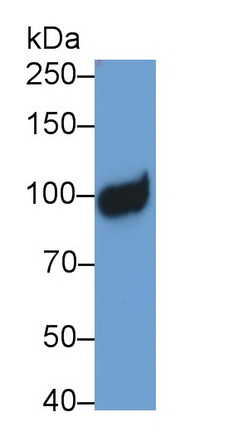 Monoclonal Antibody to Neprilysin (CD10)