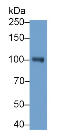 Monoclonal Antibody to Neprilysin (CD10)