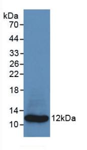 Monoclonal Antibody to S100 Calcium Binding Protein A8 (S100A8)