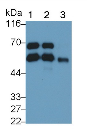 Monoclonal Antibody to Vitamin D Binding Protein (DBP)