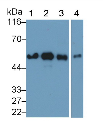 Monoclonal Antibody to Vitamin D Binding Protein (DBP)