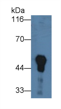 Monoclonal Antibody to Vitamin D Binding Protein (DBP)