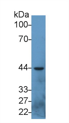 Monoclonal Antibody to Squamous Cell Carcinoma Antigen 1/2 (SCCA1/SCCA2)