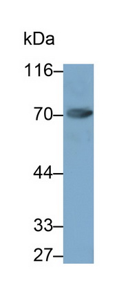 Monoclonal Antibody to Coagulation Factor XI (F11)