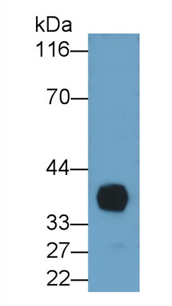 Monoclonal Antibody to Interleukin 2 Receptor Alpha (IL2Ra)