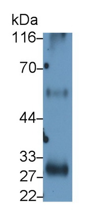 Monoclonal Antibody to Interleukin 2 Receptor Alpha (IL2Ra)