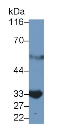 Monoclonal Antibody to Interleukin 2 Receptor Alpha (IL2Ra)