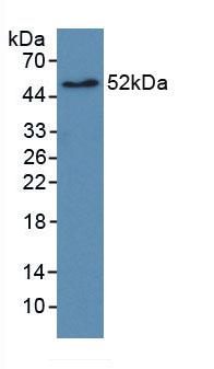 Monoclonal Antibody to Receptor Tyrosine Protein Kinase erbB-2 (ErbB2)