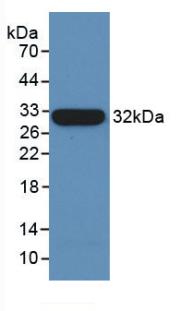 Monoclonal Antibody to Tubulin Beta (TUBb)