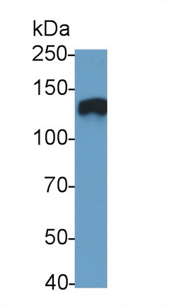 Monoclonal Antibody to Angiotensin I Converting Enzyme 2 (ACE2)