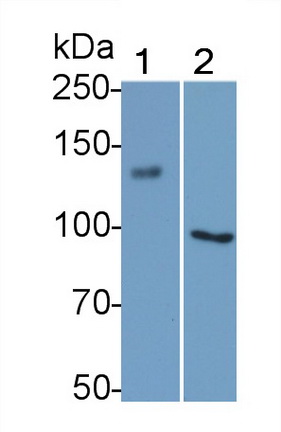 Monoclonal Antibody to Angiotensin I Converting Enzyme 2 (ACE2)