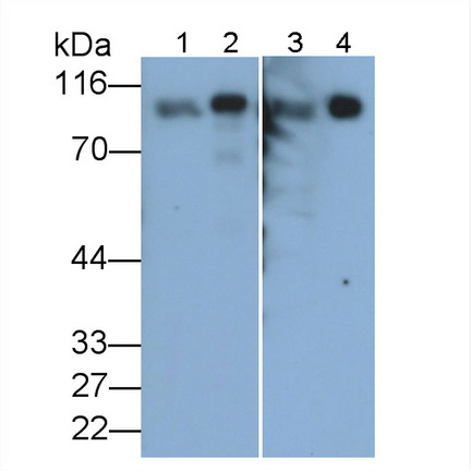 Monoclonal Antibody to Angiotensin I Converting Enzyme 2 (ACE2)