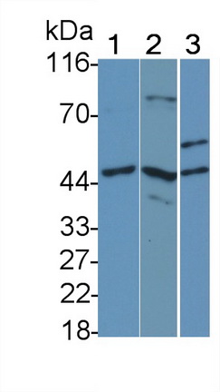 Monoclonal Antibody to Interleukin 7 Receptor (IL7R)