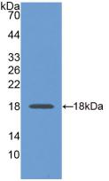 Monoclonal Antibody to Glyceraldehyde-3-Phosphate Dehydrogenase (GAPDH)