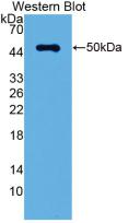 Monoclonal Antibody to Leucine Rich Alpha-2-Glycoprotein 1 (LRG1)